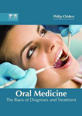 Oral Medicine: The Basis of Diagnosis and Treatment - 9781632425164